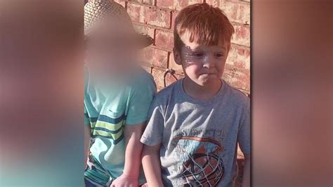 A 12-year-old boy killed his six-month-old baby brother by stabbing him 17 times and cutting off his left hand as he lay in his cot, a court was told today. . Boy killed his brother